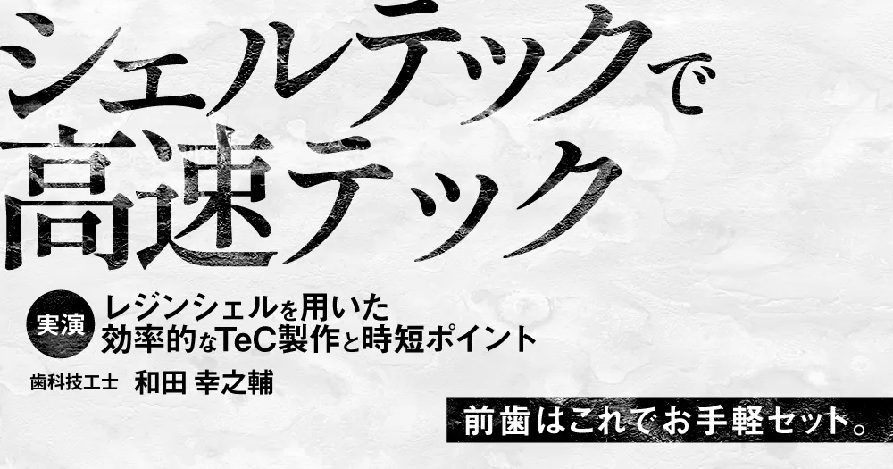 シェルテックで高速テック｜歯科オンラインセミナー・録画配信は1D
