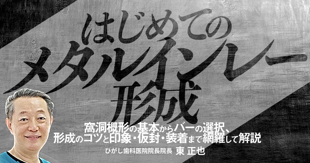 はじめての「咬合採得」｜歯科オンラインセミナー・録画配信は1D