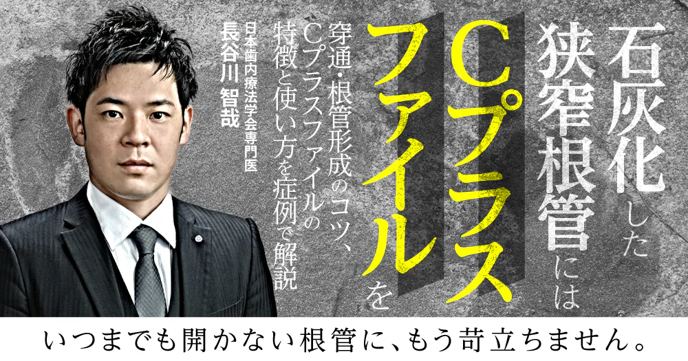 明日から使える「欠損補綴」の保険請求｜歯科オンラインセミナー・録画