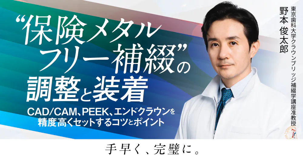 保険メタルフリー補綴”の調整と装着｜歯科オンラインセミナー・録画