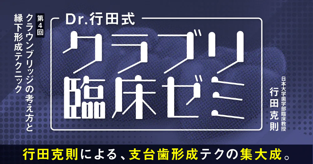 Dr.行田式「クラブリ臨床ゼミ」#4。クラウンブリッジの考え方と縁下