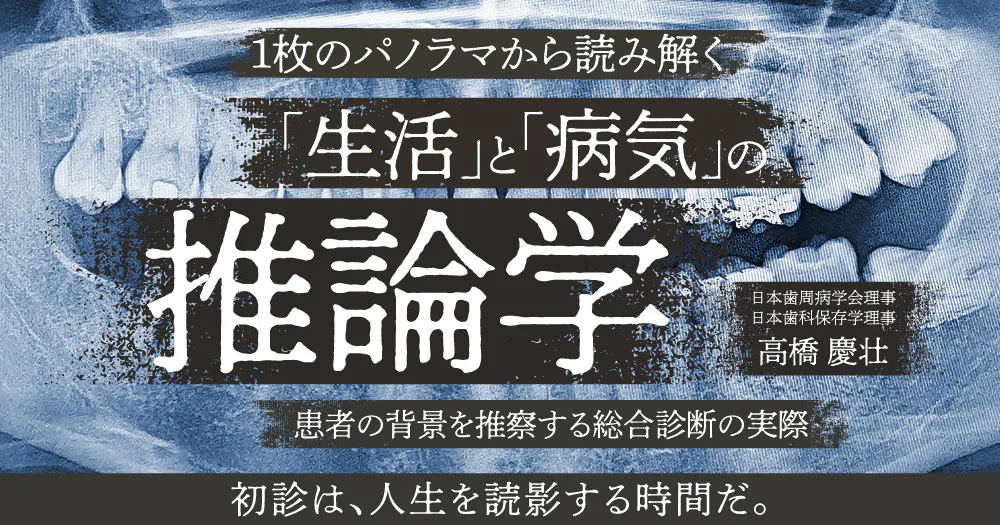 歯周治療としての「咬合調整」極み技｜歯科オンラインセミナー・録画