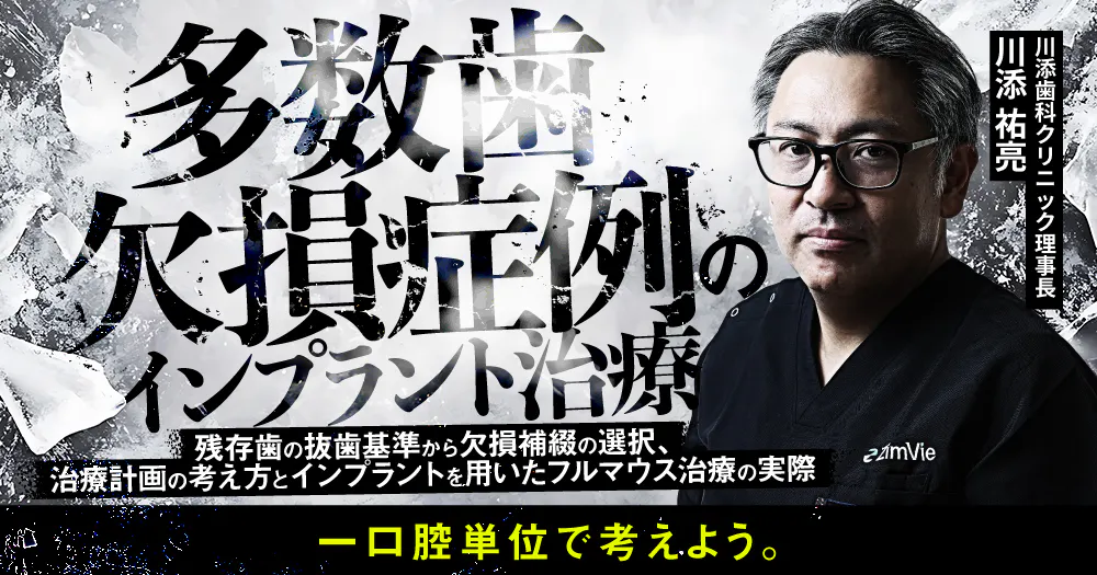 【裁断済み】多数歯欠損・無歯顎症例のインプラント治療 多数歯欠損症例のインプラント治療｜歯科オンラインセミナー・録画配信
