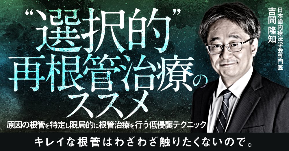 選択的”再根管治療のススメ｜歯科オンラインセミナー・録画配信は1D