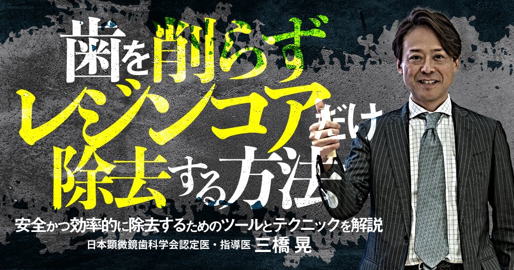 根管洗浄アップデート｜歯科オンラインセミナー・録画配信は1D