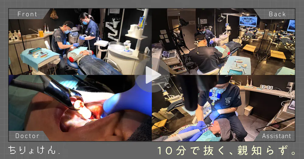 動画で学ぶ「下顎埋伏智歯抜歯」。流れや手技のポイントを解説。｜歯科