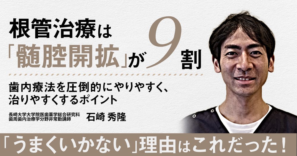 根管治療は「髄腔開拡」が9割。手順やポイントを解説｜歯科オンライン