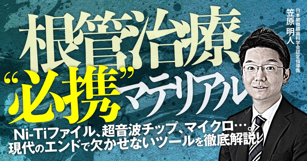 根管洗浄だけで90分。根管洗浄液の選択や根管洗浄法を解説！｜歯科