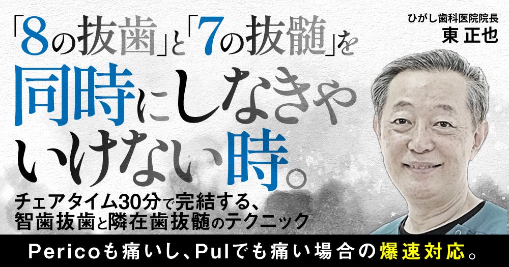 8の抜歯」と「7の抜髄」を同時にしなきゃいけない時。｜歯科オンライン