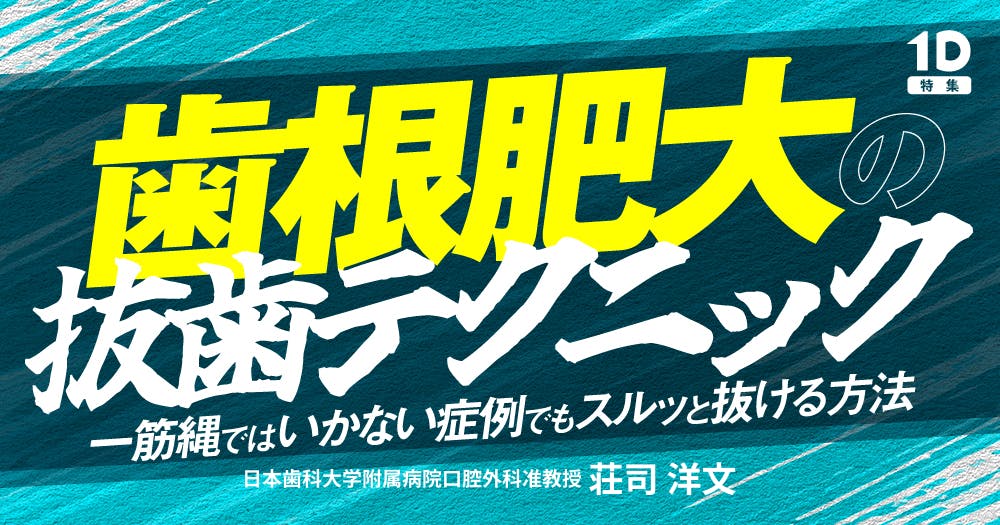 【裁断済み】抜歯テクニックコンプリートガイド : 安全にうまく抜歯するためのさま 81vxL93NLAL.jpg
