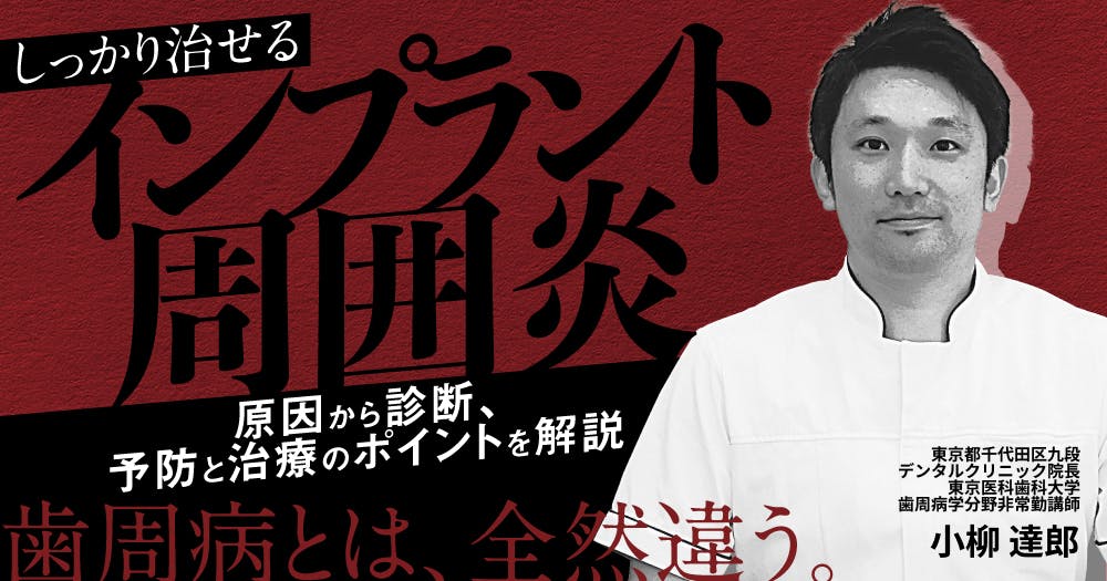 天然歯＆インプラントのための歯周組織再生療法。閉創とリグロス