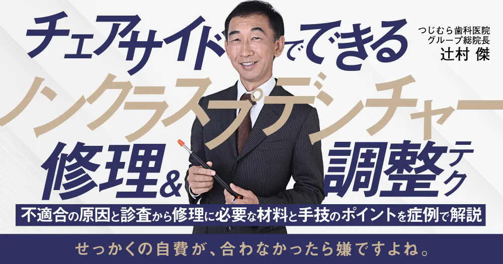 【中古】Q&amp;Aでわかる ノンメタルクラスプデンチャー ?できること,できないこと Q&Aでわかる ノンメタルクラスプデンチャー