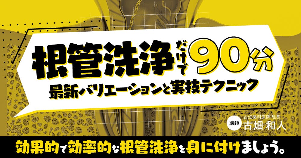 根管洗浄だけで90分。根管洗浄液の選択や根管洗浄法を解説！｜歯科