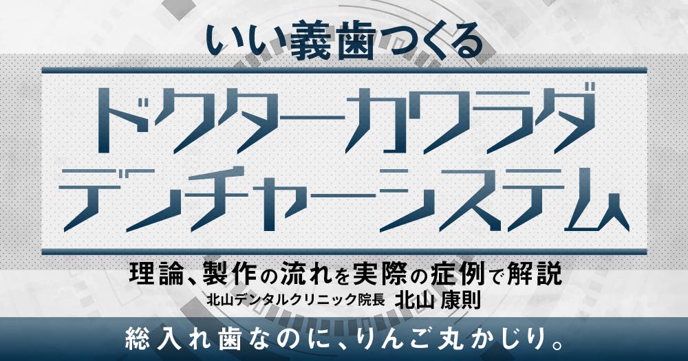 lIo1hAfSowdFTKvkUAwQ0vP5qvMafN