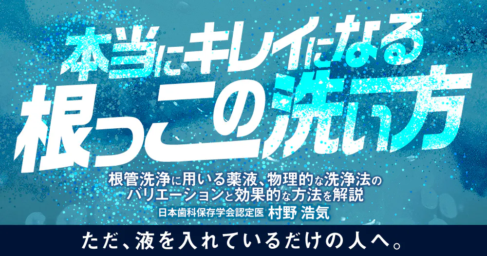 根管洗浄アップデート｜歯科オンラインセミナー・録画配信は1D