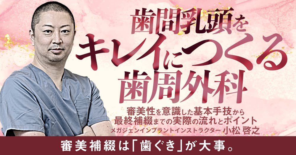 歯に優しいけどムズかしい、接着ブリッジの臨床論。デザイン・形成の