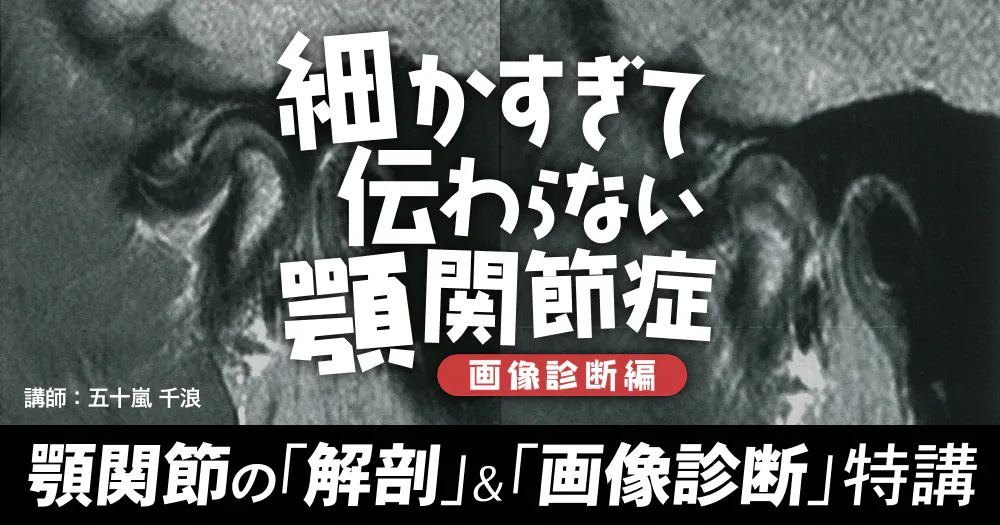 顎関節症はこうして治す : すぐできる診断法と治療の実際 61kckcO290L.jpg_BO30,255,255,
