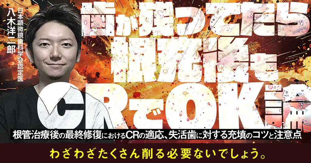 歯が残ってたら根充後もCRでOK論｜歯科オンラインセミナー・録画配信は