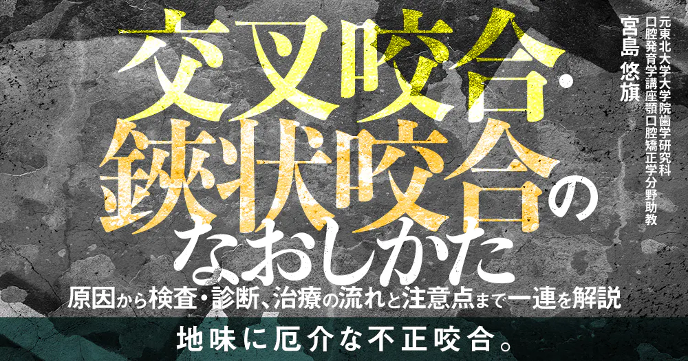 交叉咬合・鋏状咬合のなおしかた|歯科オンラインセミナー・録画配信は 交叉咬合・鋏状咬合のなおしかた|歯科オンラインセミナー・録画配信は