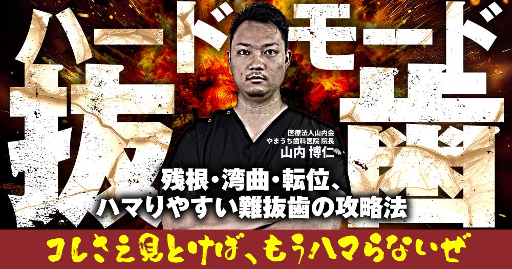 【裁断済】【即日発送】科学的根拠に基づいた ビジュアル下顎埋伏智歯抜歯 41Ox1sOhxdL._AC_SY200_QL15_.jpg