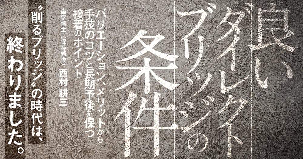 ヒューマンブリッジ」形成テクニック｜歯科オンラインセミナー・録画