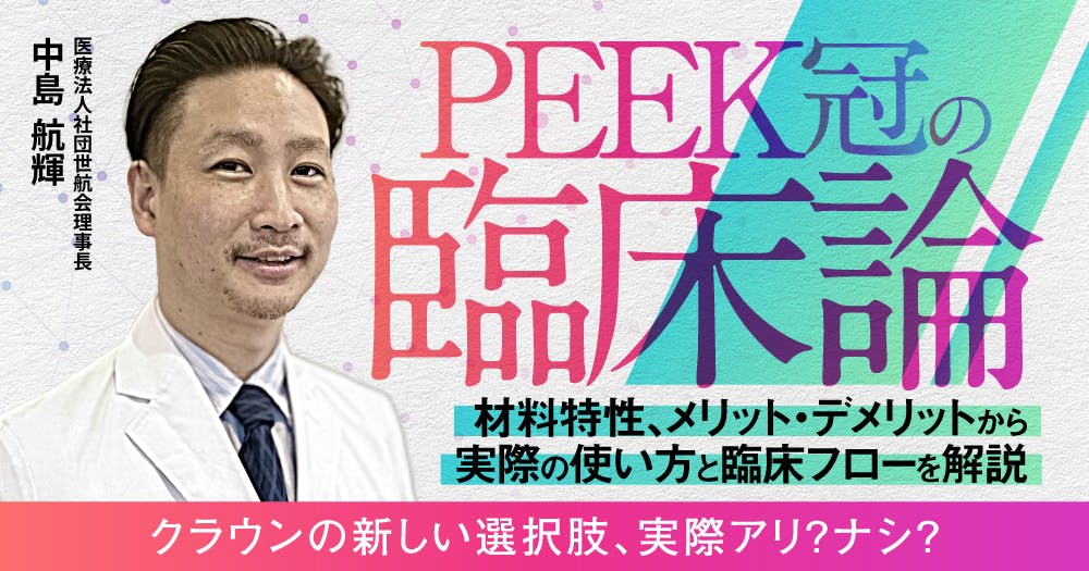 写真でマスターする 寒天アルジネート連合印象による誰でもできる簡単精密印象 写真でマスターする 寒天アルジネート連合印象による誰でも