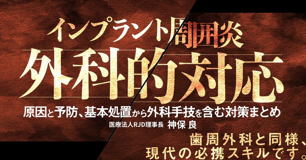 【裁断済み】インプラント周囲炎 ゼロコンセプト インプラント周囲炎ゼロコンセプト: 科学的根拠に基づいた多角的