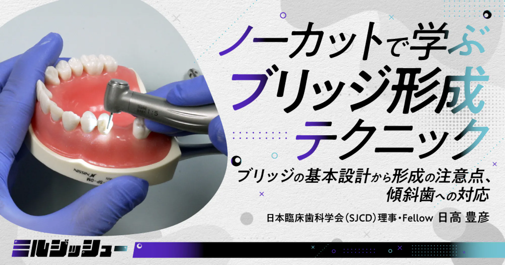 ノーカットで学ぶ「ブリッジ形成」テクニック｜歯科オンラインセミナー
