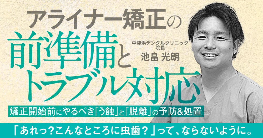 アライナー矯正の前準備とトラブル対応。矯正開始前にやるべき「う蝕