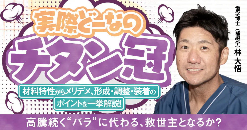 実際どーなの「チタン冠」｜歯科オンラインセミナー・録画配信は1D