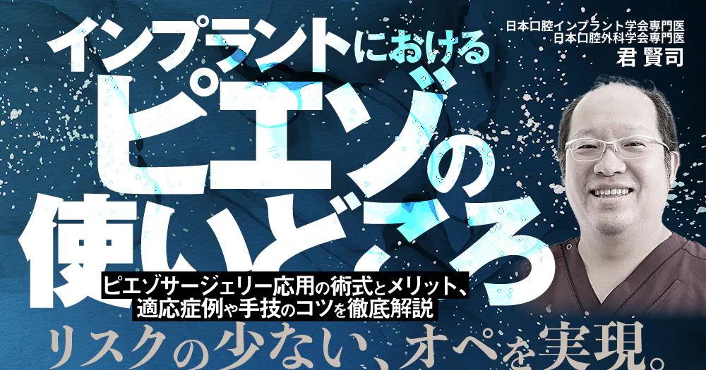 インプラントにおけるピエゾの使いどころ｜歯科オンラインセミナー