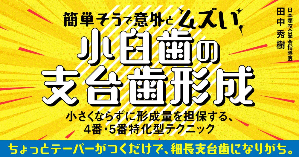 支台歯形成のかんどころ : うまい形成下手な形成 支台歯形成