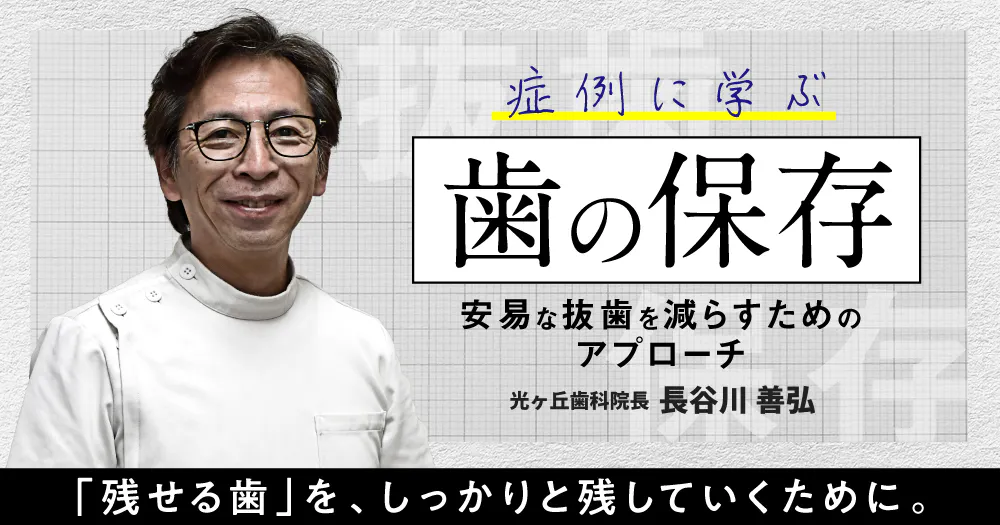 大きな根尖病変」を殲滅する。診断・治療法の選択と難症例に対する根管