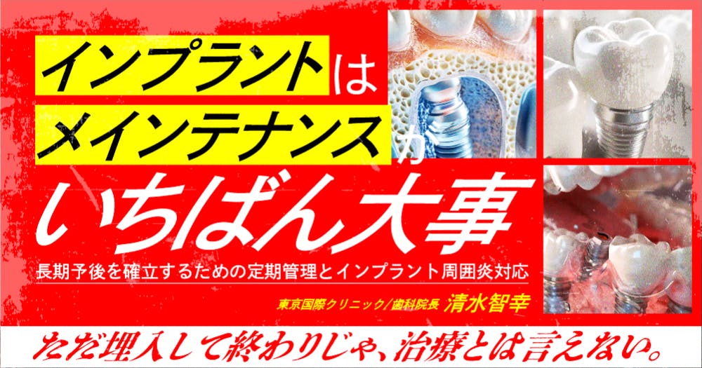 【新品】インプラント周囲炎 予防マニュアル Amazon.co.jp: インプラント周囲炎を治療する: エビデンスに