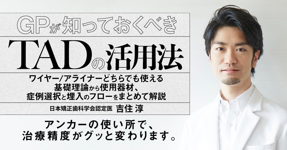 インプラント「撤去」の診断とテクニック｜歯科オンラインセミナー