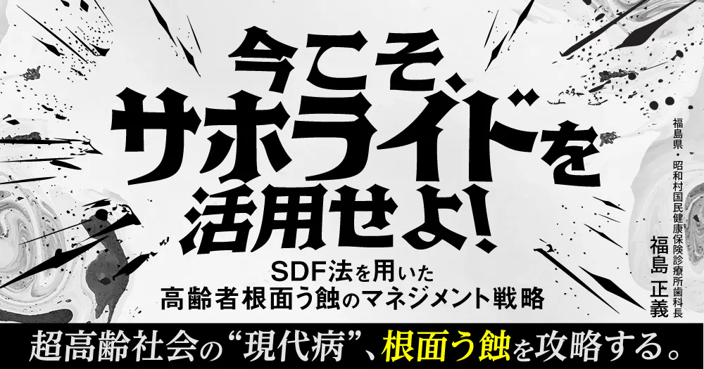 SDF法 : フッ化ジアンミン銀を活用した根面う蝕マネジメント 書評『SDF法―フッ化ジアンミン銀を活用した根面う蝕マネジメント