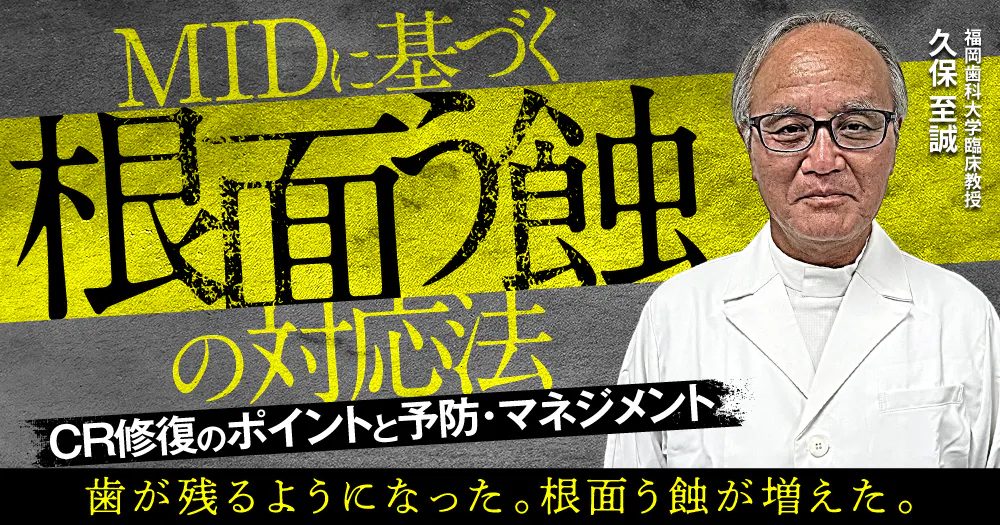 今こそ、サホライドを活用せよ！SDF法について解説｜歯科オンライン