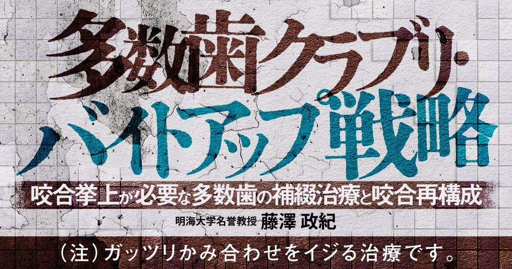 咬合再構成における「咬合高径」の考え方｜歯科オンラインセミナー