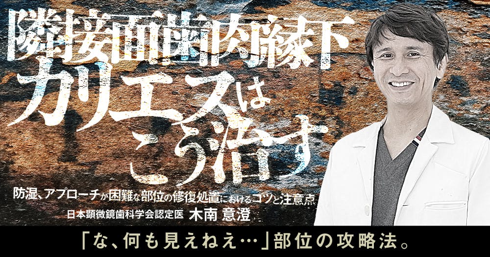 インプラント「撤去」の診断とテクニック｜歯科オンラインセミナー