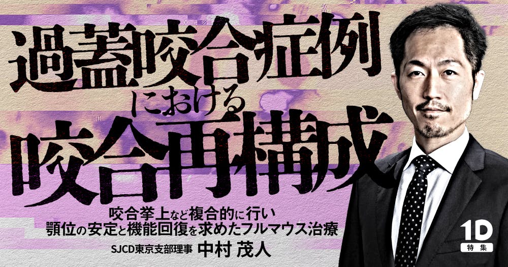 【裁断済み】咬合再構成 その理論と臨床 咬合再構成 その理論と臨床 - クインテッセンス出版