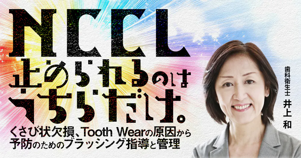 NCCL止められるのはうちらだけ。｜歯科オンラインセミナー・録画配信は