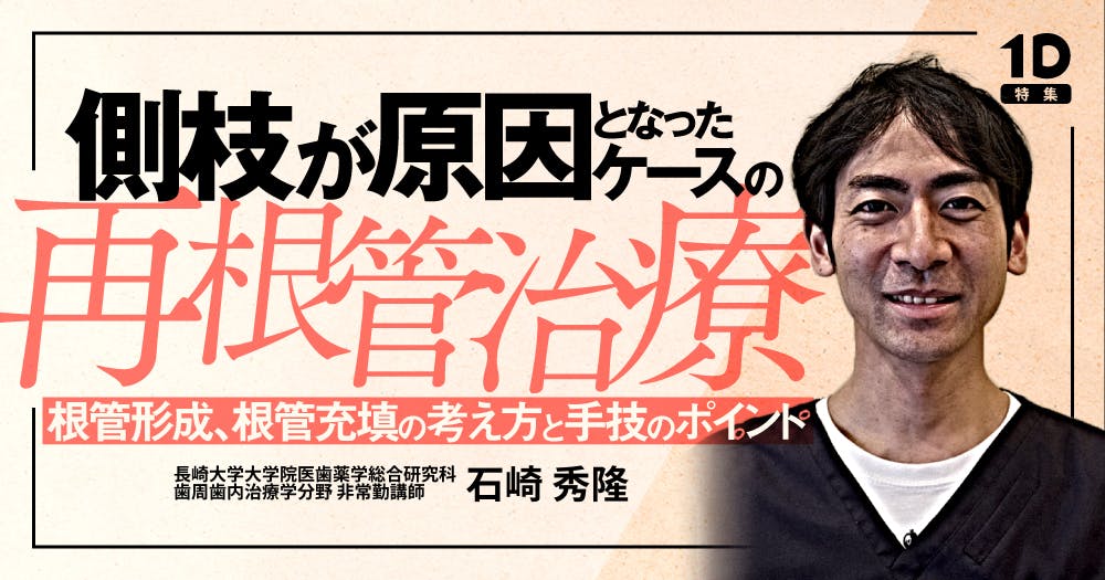 側枝が原因となったケースの再根管治療｜歯科オンラインセミナー・録画