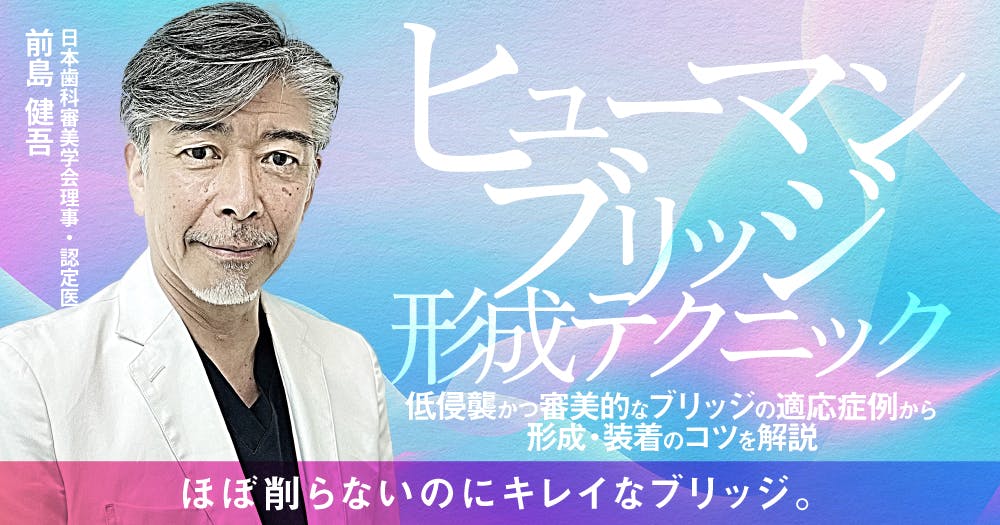 歯に優しいけどムズかしい、接着ブリッジの臨床論。デザイン