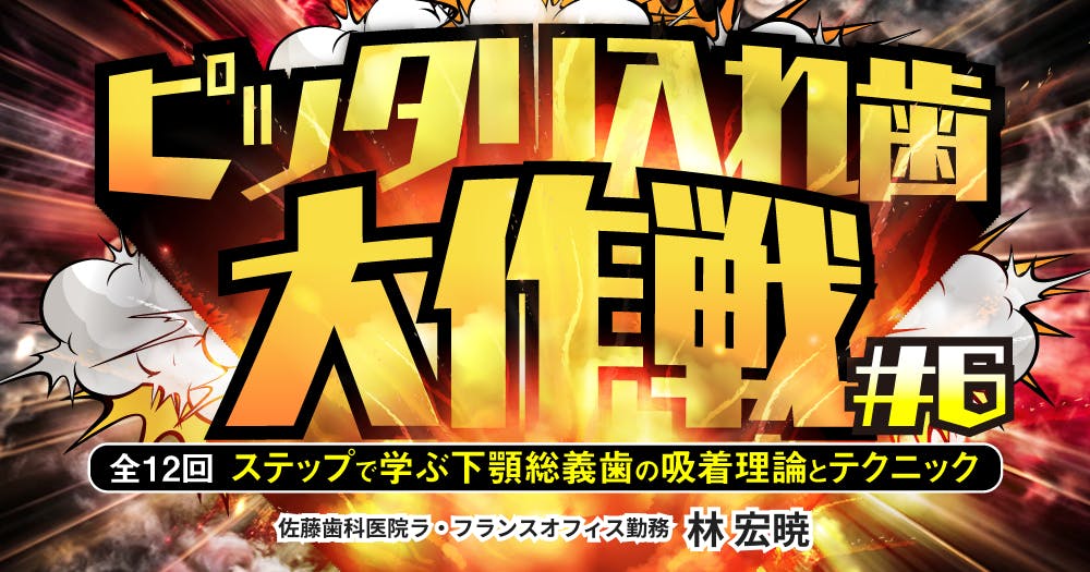 ピッタリ入れ歯大作戦#1ステップで学ぶ下顎総義歯の吸着理論と